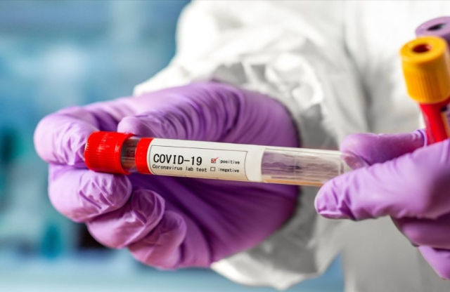 У Кам’янському ще 4 хворих на COVID-19 , а ДМК стає епіцентром ураження коронавірусом (ОНОВЛЕНО)