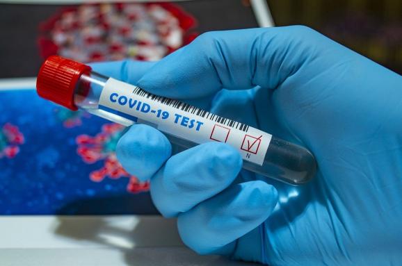 Офіційна статистика захворювання коронаірусом у Кам’янському