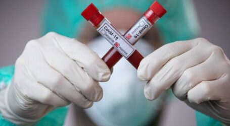 Офіційна статистика захворювання коронавірусом у Кам’янському