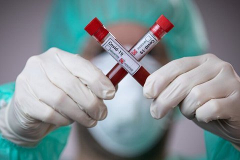 Офіційна статистика захворювання коронавірусом у Кам’янському