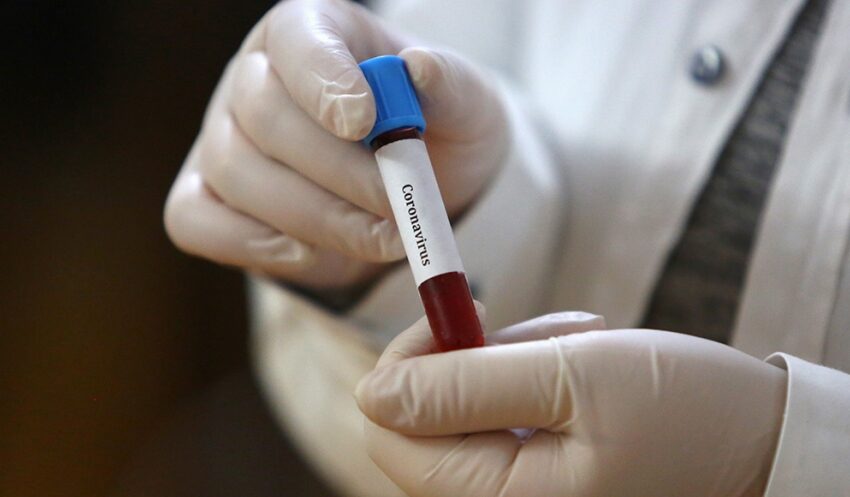 Офіційна статистика захворювання коронавірусом у Кам’янському