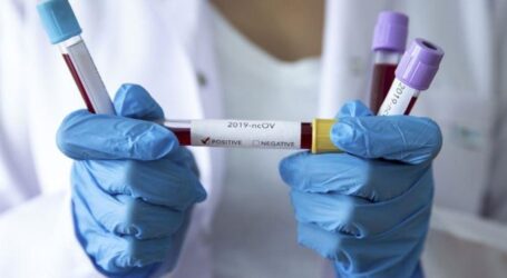 Офційна статистика захворювання коронавірусом у Кам’янському