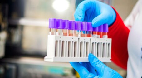 Офіційна статистика захворювання коронавірусом у Кам’янському