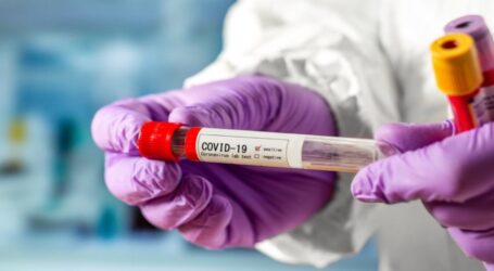 За минулу добу у Кам’янському 140 нових випадків COVID-19