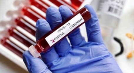 У Кам’янському знизився рівень захворюваності на COVID-19