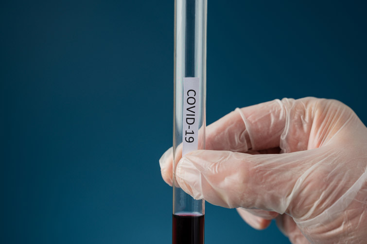 У ВООЗ занепокоєні зростанням випадків нового підвиду COVID-штаму Omicron