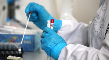 У стічних водах на Дніпропетровщині виявлено новий варіант штаму SARS-CoV-2 Omicron