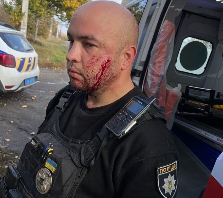 На Дніпропетровщині 32-річний чоловік порізав ножем себе, а потім поліційного, який намагався його заспокоїти