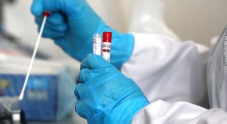 На Дніпропетровщині захворюваність на гепатит A не перевищує епідпоріг