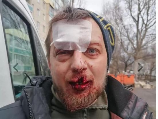 Поліційні Кам’янського встановлюють можливих свідків нападу на місцевого громадського діяча