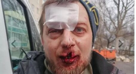 Поліційні Кам’янського встановлюють можливих свідків нападу на місцевого громадського діяча