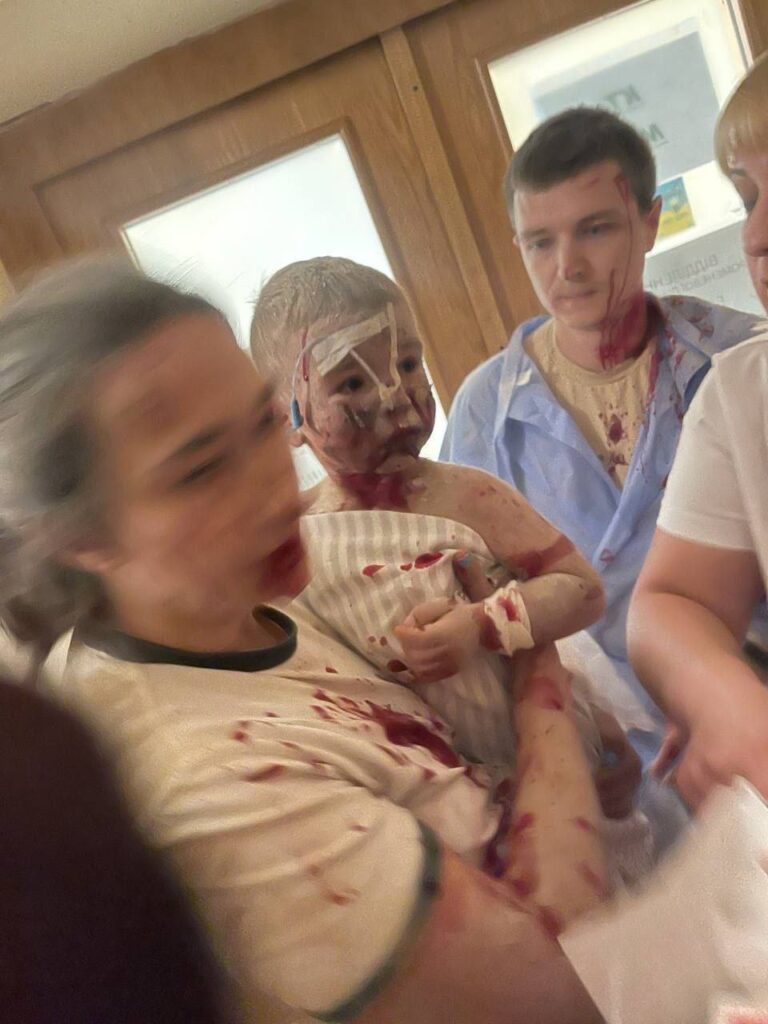 Від ранкової ракетної атаки сильно постраждали Кривий Ріг, Київ та Дніпро, є загиблі та поранені - ФОТО