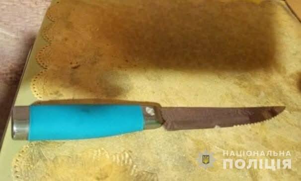 В Кам'янському під час сварки чоловік вдарив ножем у живіт 19-річного хлопця - ФОТО