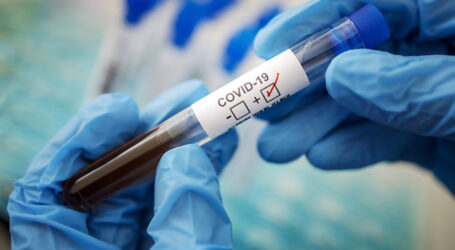 У Дніпропетровській області зростає кількість випадків COVID-19