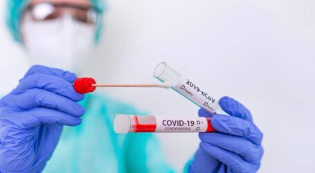 На Дніпропетровщині три людини померли через COVID-19: яка епідеміологічна ситуація в регіоні