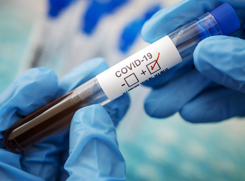 У Дніпропетровській області зростає кількість випадків COVID-19