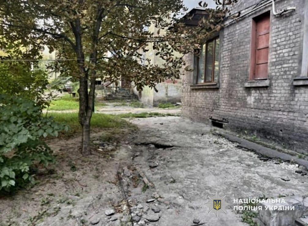 Вдарив знайомого трубою по голові: в Кам'янському суперечка закінчилась лікарнею для одного з учасників - ФОТО